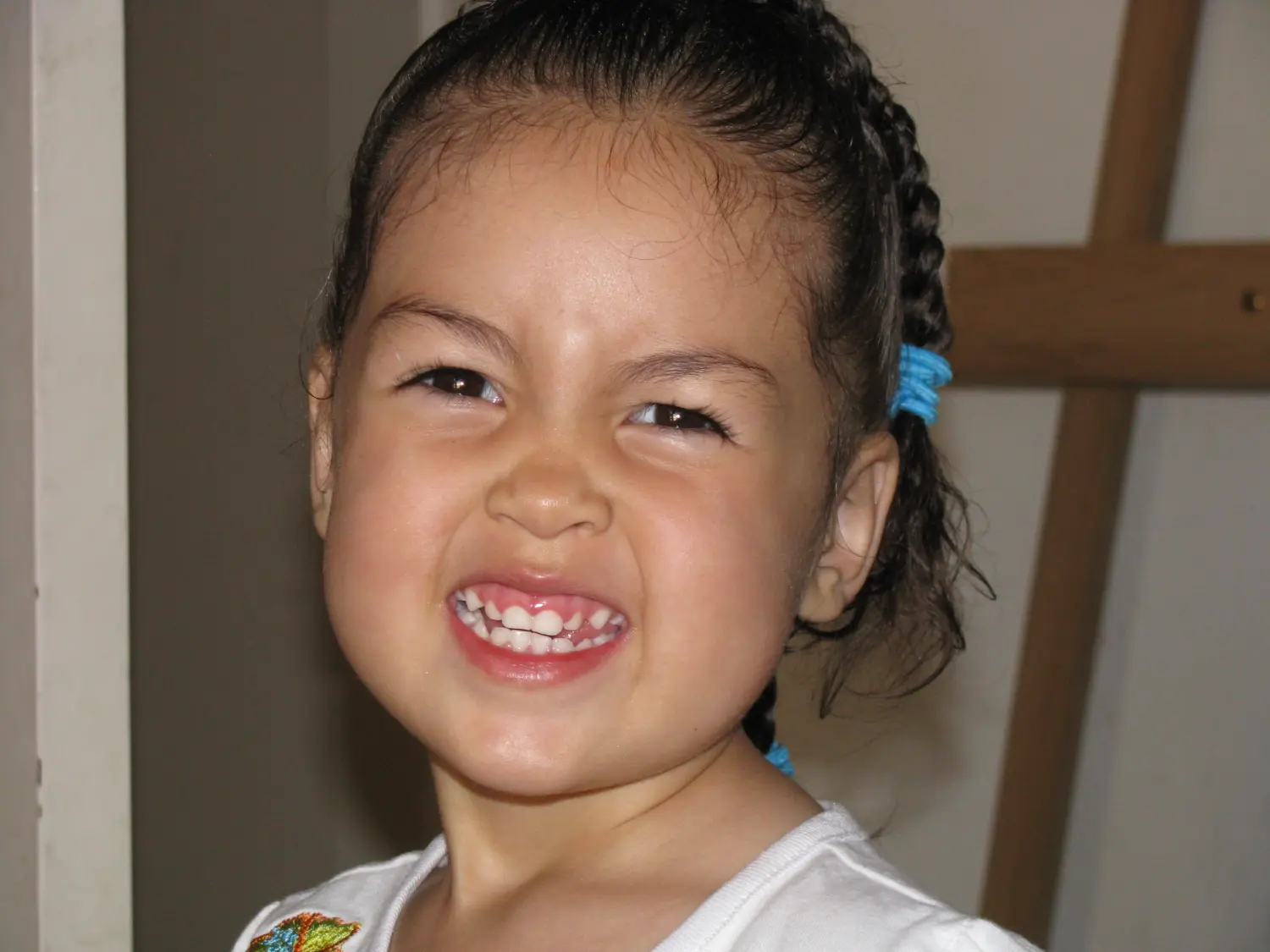 Natlie Ann Löffler, Image of a kid showing his teeth